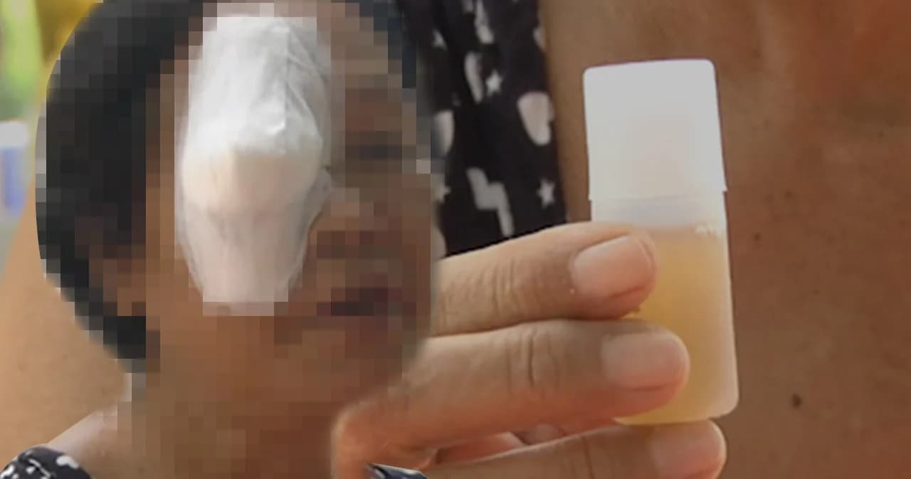 อันตายอาหารเสริมหยอดตา ส่งผลร้ายแรงถึงขั้นตาบอด