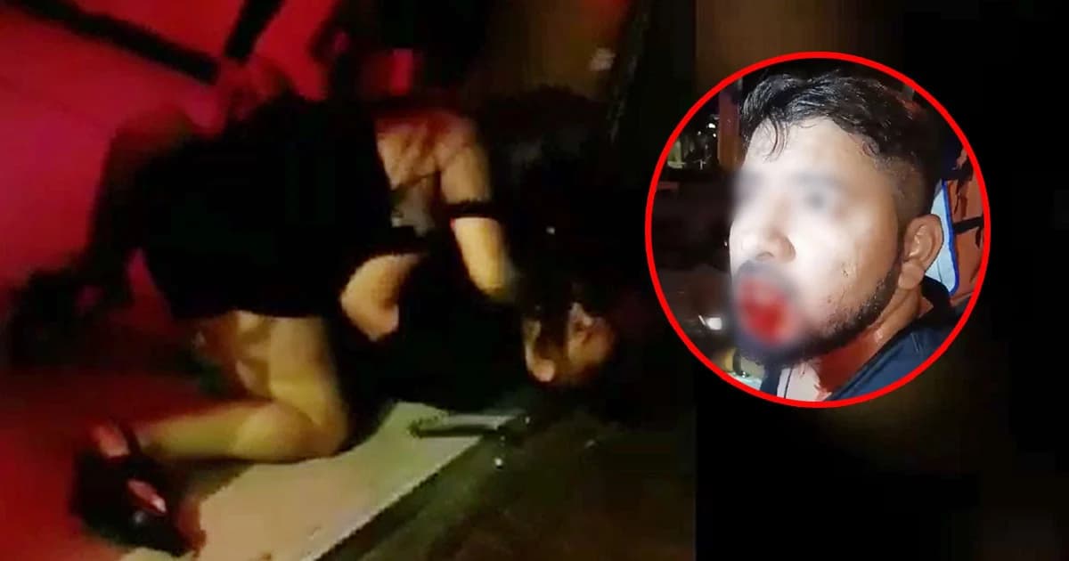 หนุ่มอินเดียวิวาทสาวไทยถูกกัดปากแหว่ง เลือดกบปาก !