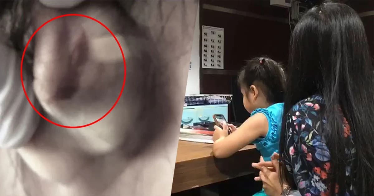 โรงเรียนยังเงียบ ! หลังเด็กหญิง 5 ขวบ ถูกครูพี่เลี้ยงบิดหูเป็นแผลฉีก