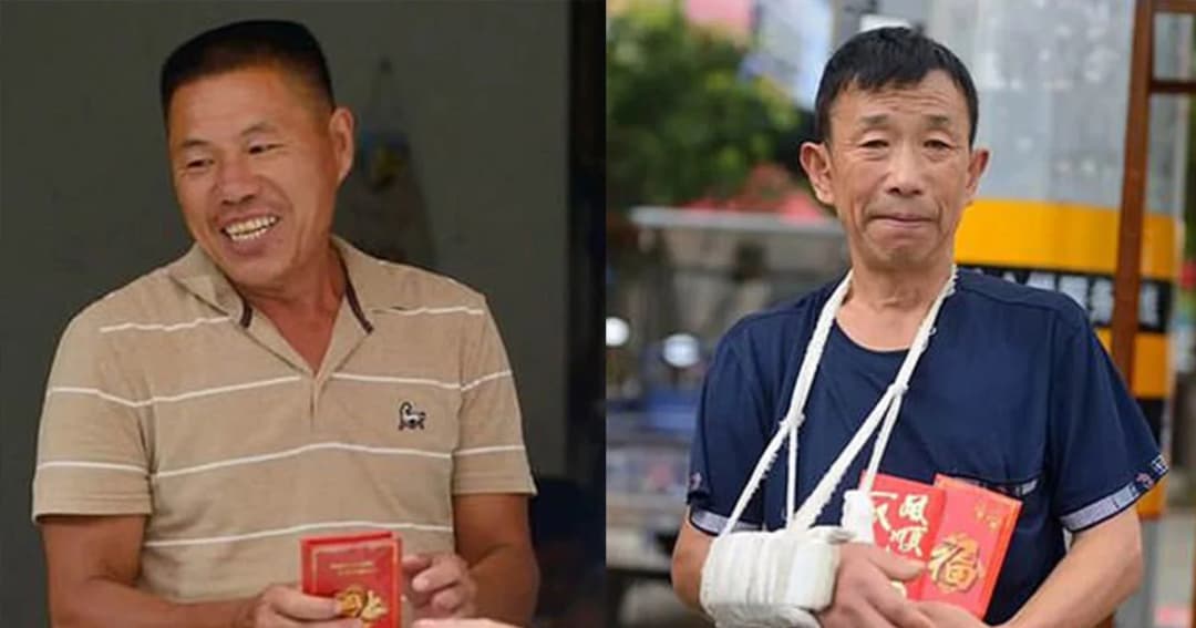 ฮีโร่หนุ่มรับเด็กตกตึก 18 เมตร จนแขนหัก