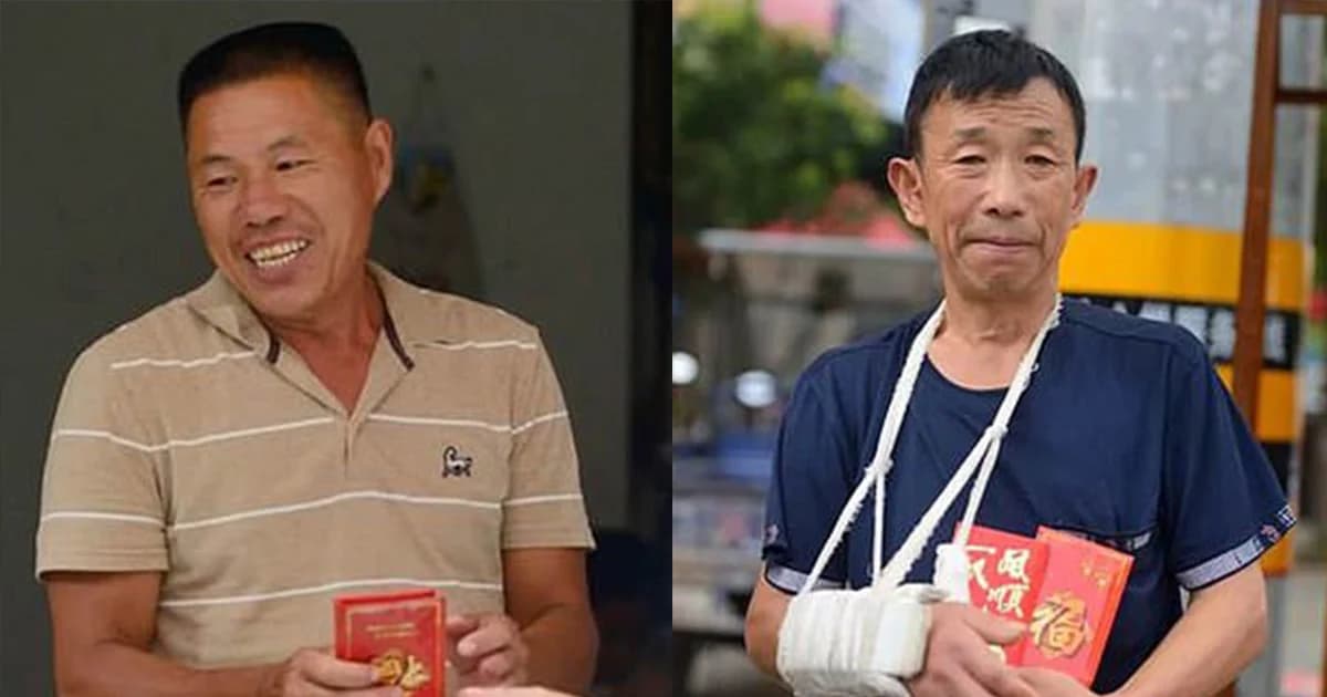 ฮีโร่หนุ่มรับเด็กตกตึก 18 เมตร จนแขนหัก