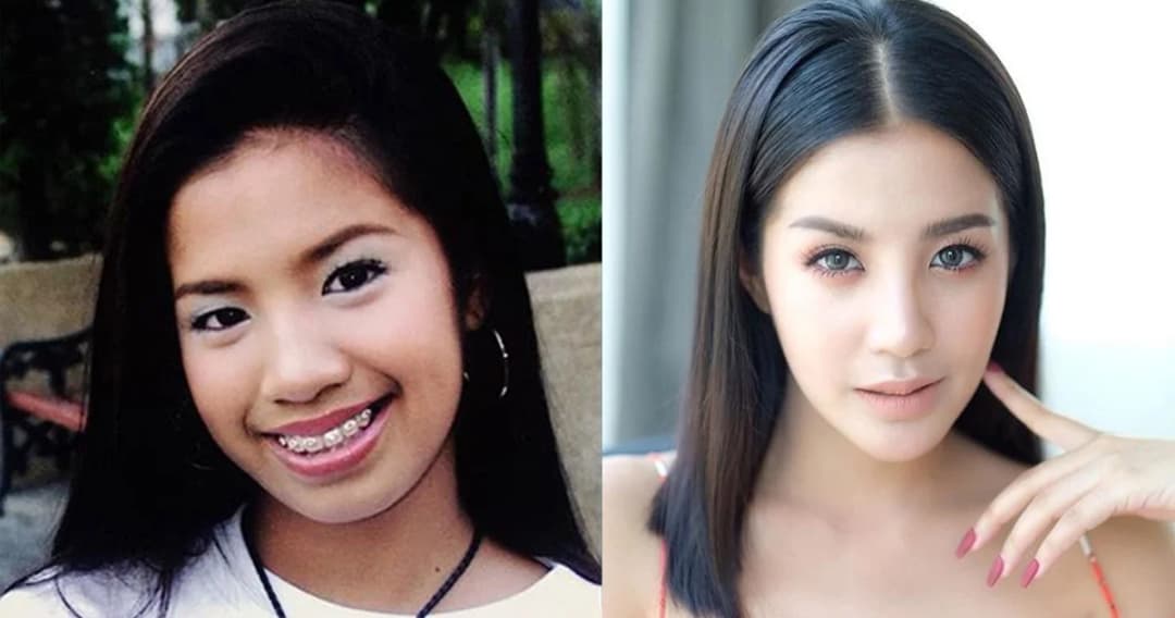 “ใบเตย” ยัน ไม่เคยศัลยกรรม แค่จัดฟันกับจ้างช่างแต่งหน้า