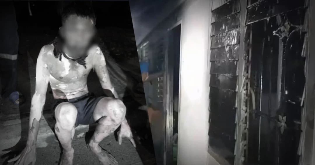 หนุ่มหึงโหด ! ราดน้ำมันเผาเมีย ลามโดนลูก 3 ขวบ และน้าสาวเจ็บสาหัส