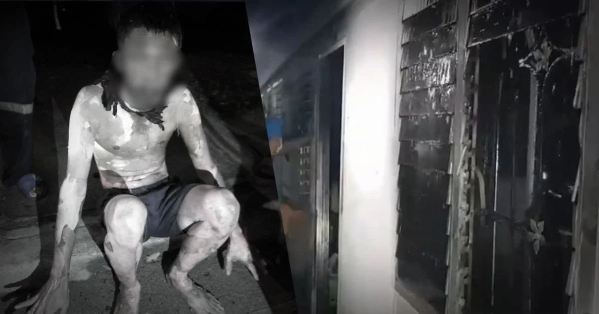 หนุ่มหึงโหด ! ราดน้ำมันเผาเมีย ลามโดนลูก 3 ขวบ และน้าสาวเจ็บสาหัส