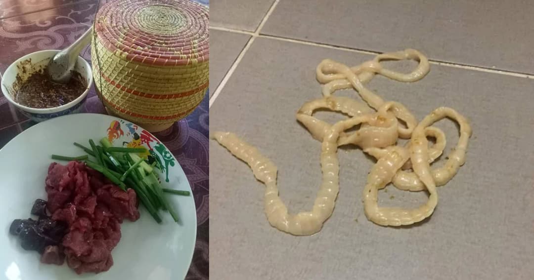 สาวหล่อโพสต์ “กลัวตัวเอง” นึกว่าไส้หลุดที่แท้พยาธิตัวตืด