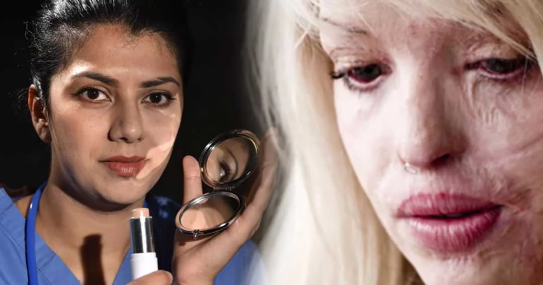 คุณหมอสาวอินเดีย คิดค้นเครื่องสำอางกันน้ำกรดสาดหน้า ครั้งแรกของโลก