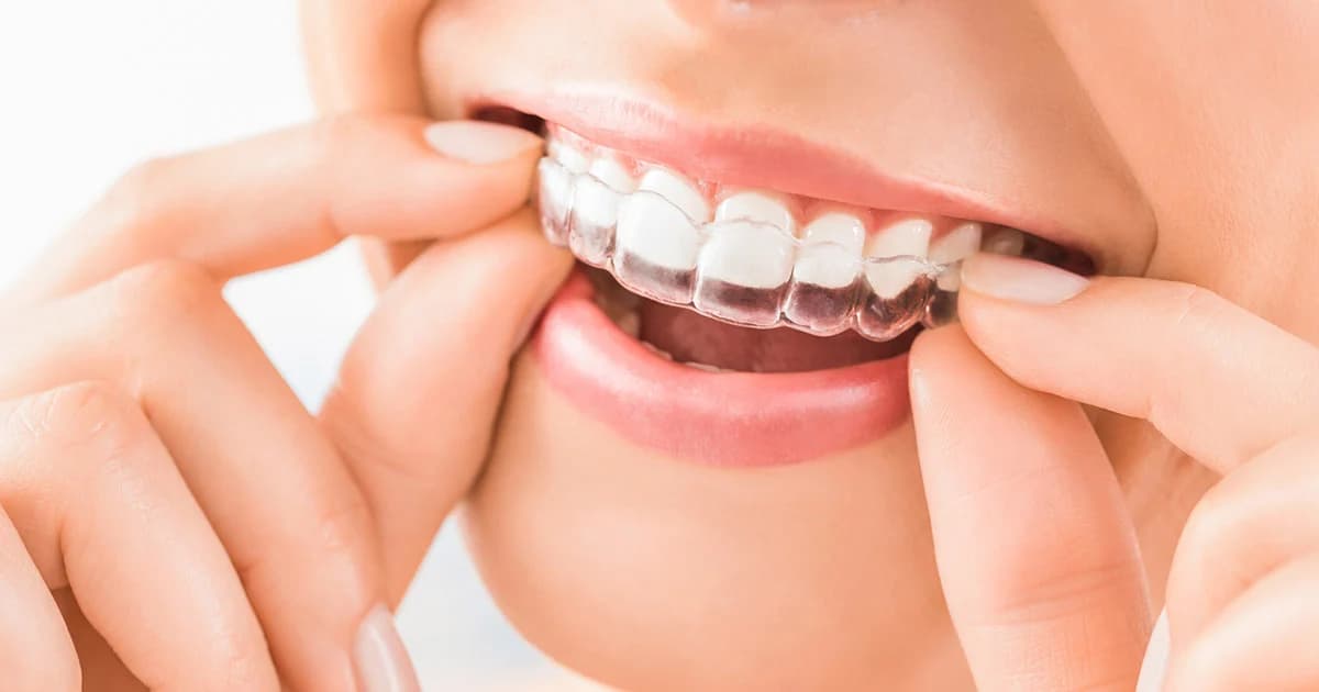 กฎใหม่ ‘ผลิตภัณฑ์ฟอกสีฟัน’ เป็นเครื่องมือแพทย์