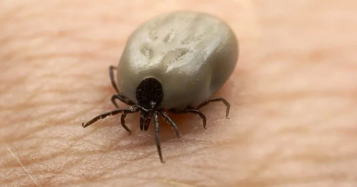 แม่โพสต์เตือน ‘เห็บ’ เข้าหูลูกชายไม่รู้ตัวนานร่วมสัปดาห์