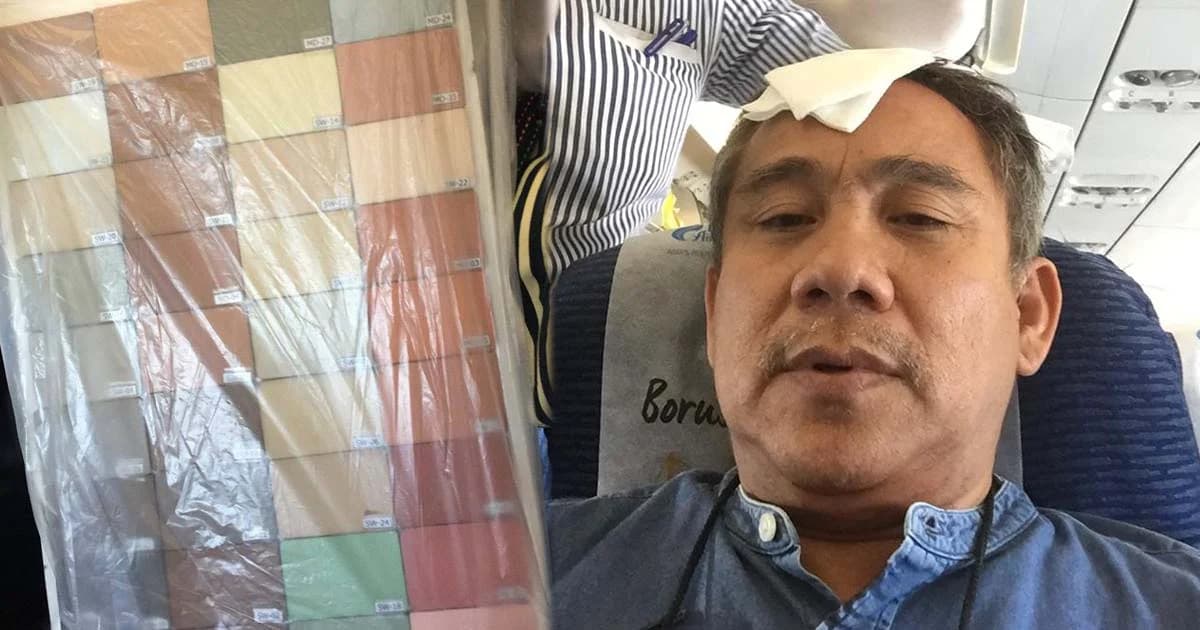 “ศุ บุญเลี้ยง” โดนกระเบื้องหล่นใส่หัวคาเครื่องบิน-เย็บ 7 เข็ม