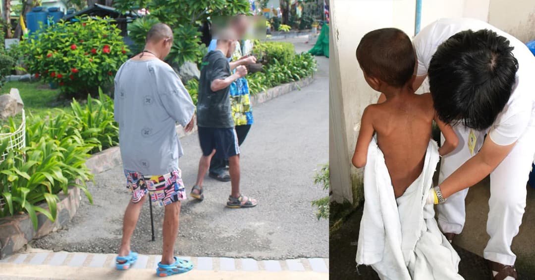 1ธ.ค.วันเอดส์โลก แนะกลุ่มเสี่ยงตรวจเอดส์ฟรีปีละ 2 ครั้ง เผยมีผู้ติดเชื้อเอชไอวีใหม่ วันละ 15 คน