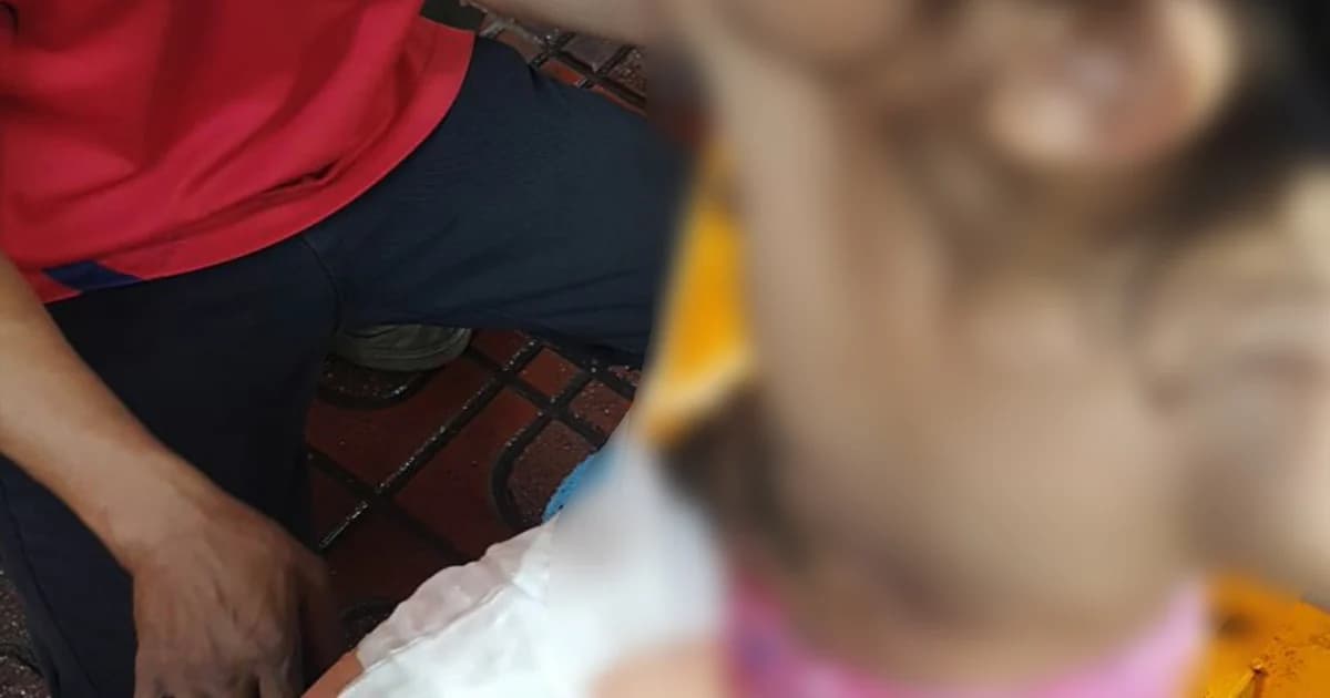 ลูกโป่งอัดแก๊สระเบิดใส่เด็กหญิงวัย 6 ขวบ ในงานวันเด็ก ล่าสุดปลอดภัยแล้ว