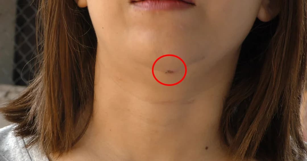 ตำรวจจ่อออกหมายจับ หนุ่มหื่นบุกรัดคอพยายามข่มขืนสาว