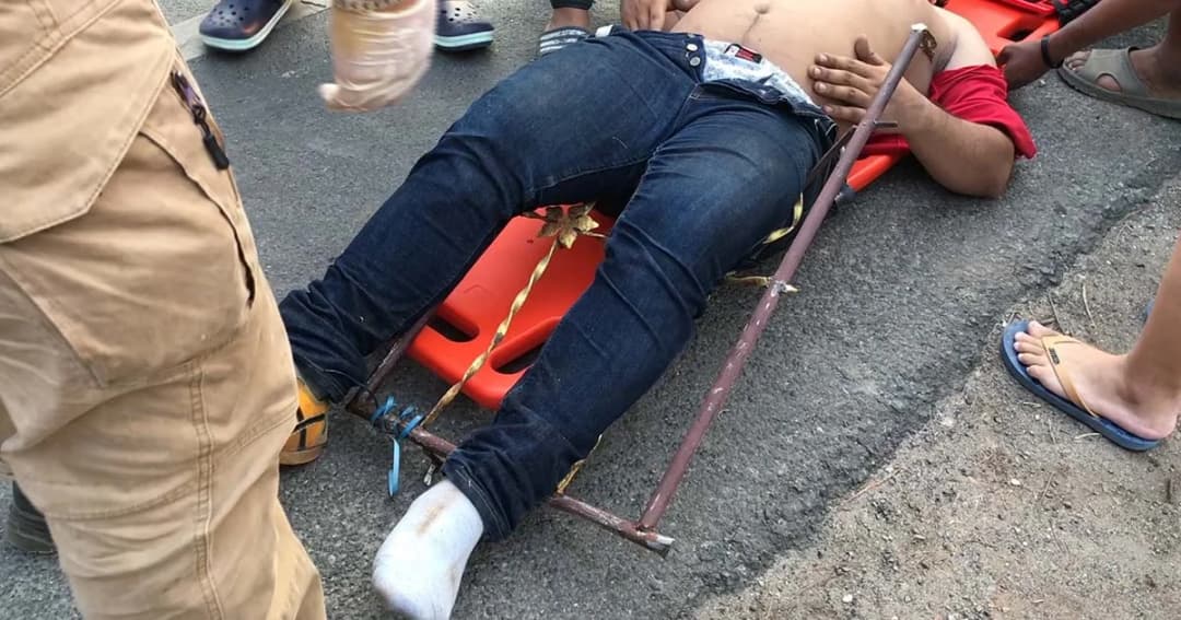 ลืมล็อกสายเซฟตี้ ช่างเคเบิลตกเสาถูกเหล็กรั้วเสียบ