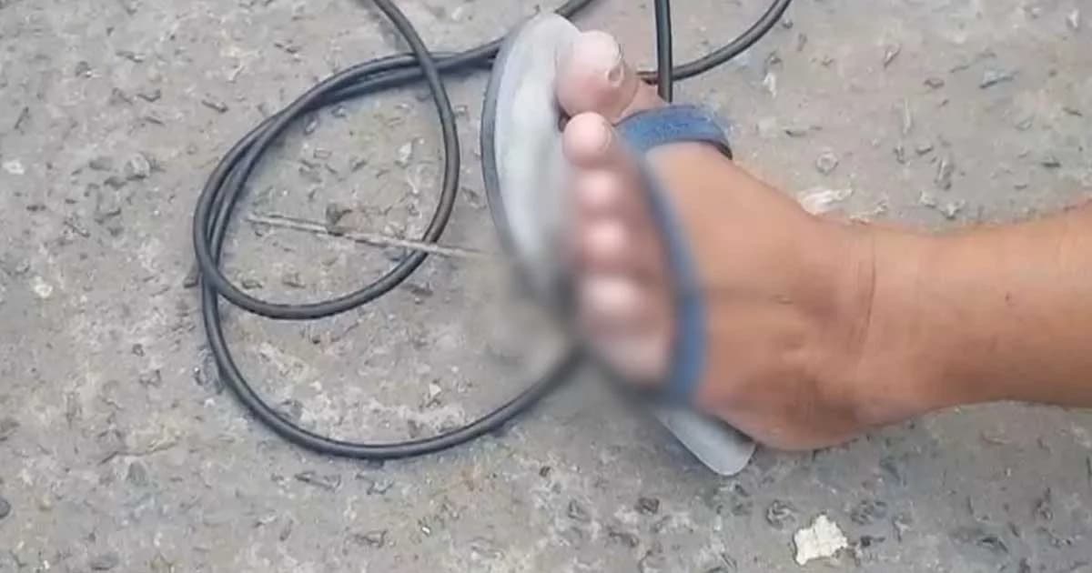 อุทาหรณ์ พ่อค้าขายไส้กรอกอีสาน โดนเหล็กเส้นถนนชำรุดแทงคาเท้า