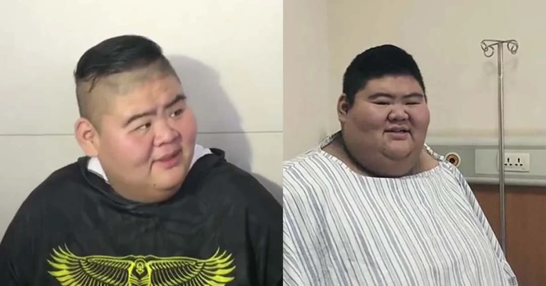 หนุ่มจีนสร้างสถิติลดน้ำหนักมากที่สุด 140 กิโลกรัม ภายใน 6 เดือน