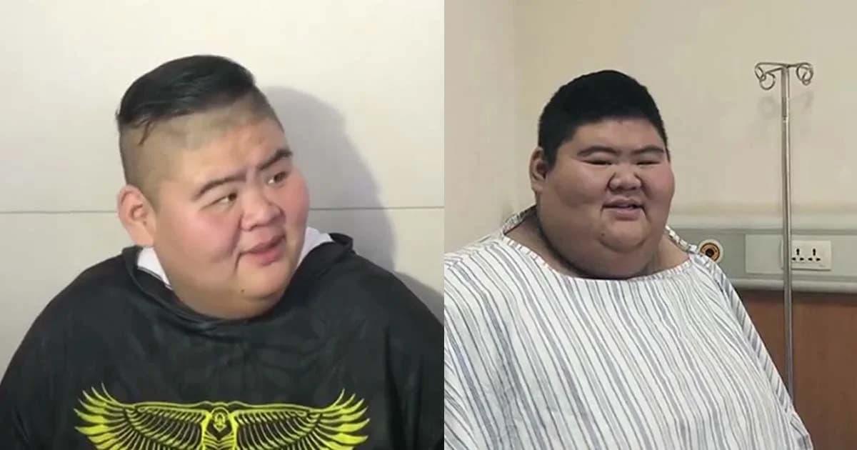หนุ่มจีนสร้างสถิติลดน้ำหนักมากที่สุด 140 กิโลกรัม ภายใน 6 เดือน