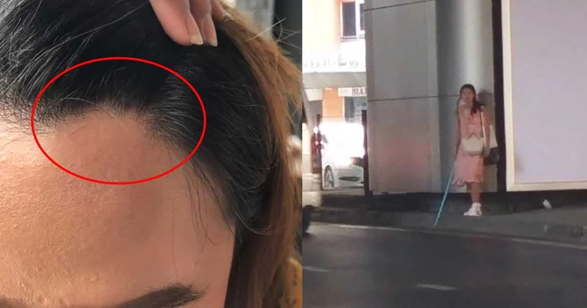 สาวออฟฟิศเดินอยู่ดีๆ โดนหญิงแปลกหน้าใช้ท่อพีวีซีฟาดกลางหัว