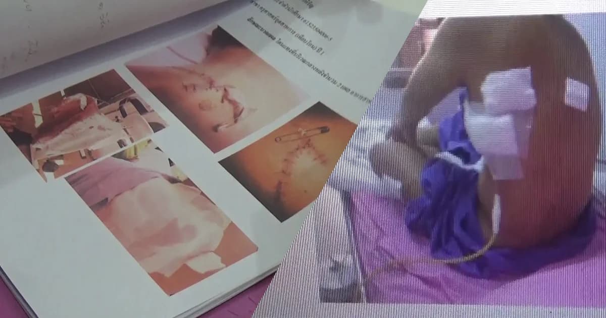 ตร.จ่อแจ้งข้อหา รุ่นพี่ ม.ดัง จ.เชียงใหม่ ชักคัตเตอร์แทงรุ่นน้องไส้ทะลัก สาหัสรวม 5 คน