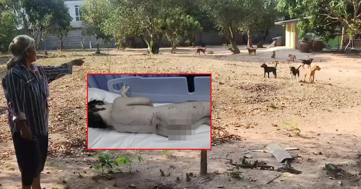 ญาติชี้จุด ! ฝูงสุนัข 10 ตัว รุมกัด ด.ช. 3 ขวบ เจ็บสาหัส เผยรู้สึกสะเทือนใจเห็นหลานทรมาน