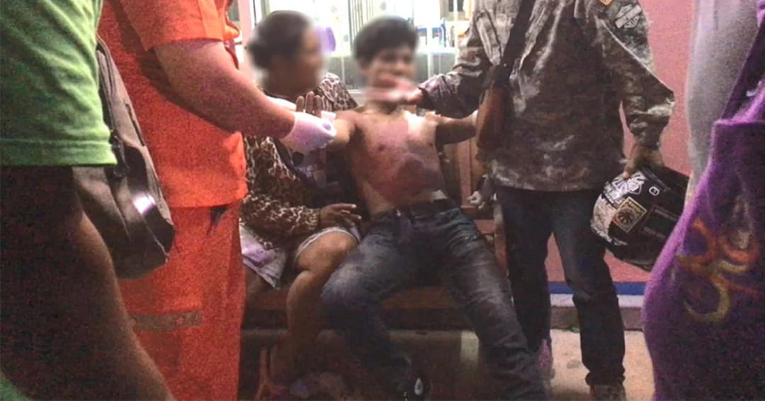 หนุ่มวัย 19 ซิ่งชนท้าย จยย.สาวท้อง 7 เดือน ตกเลือด เจ็บสาหัส