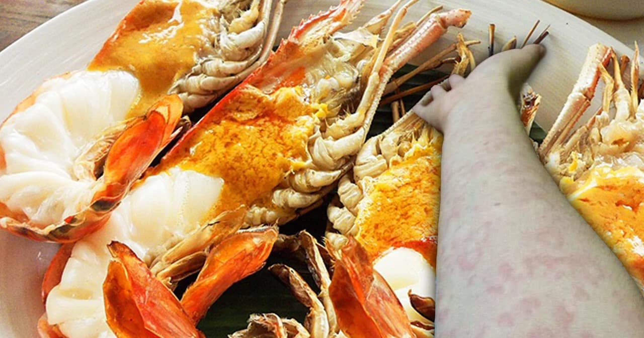 “คนแพ้กุ้ง” ฟังทางนี้ ธรรมศาสตร์เร่งวิจัย หาทางรักษาให้หายขาด