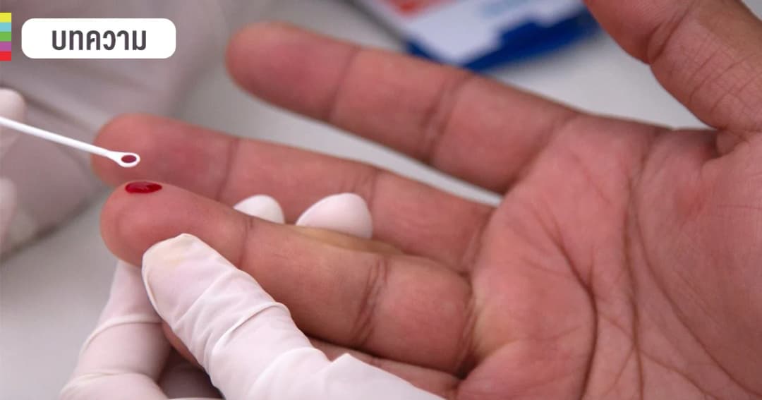 เปิดข้อมูล… คนไทยสามารถตรวจเอดส์ได้ฟรี 2 ครั้งต่อปี