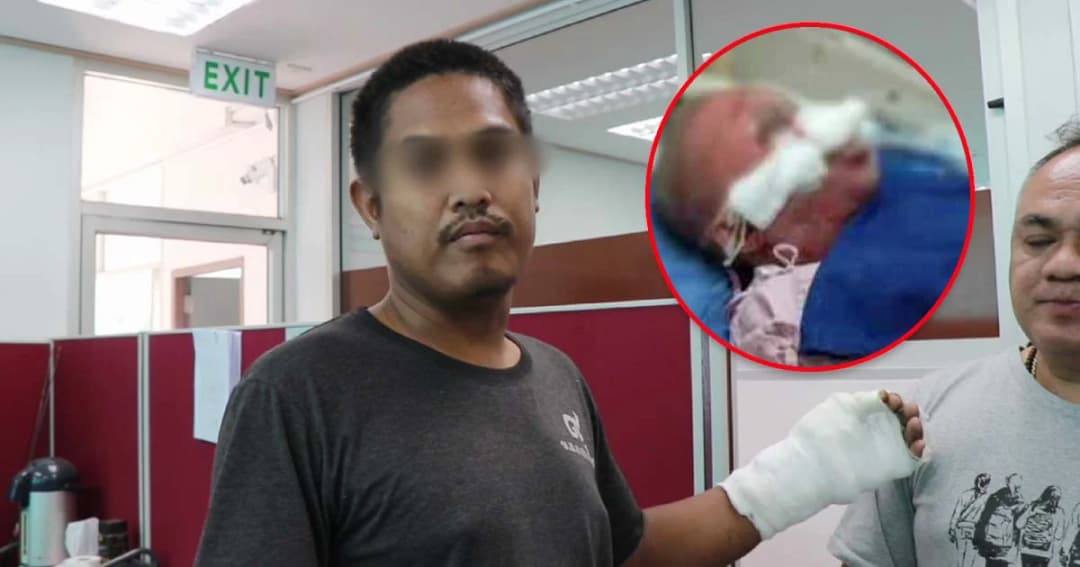 พิษณุโลก ผัวราดน้ำมันจุดไฟเผาเมียมอบตัว รับหึงเพราะเสื้อตัวเดียวแต่ไม่ตั้งใจทำร้าย