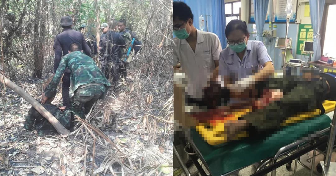 ทหาร กกล.สุรนารี เหยียบกับระเบิดชายแดนไทย-กัมพูชา จ.อุบลฯ ข้อเท้าขวาขาด 1 นาย