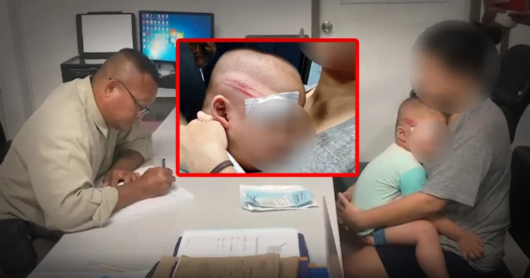 อาสาชลบุรีซุ่มจับรถหนีด่าน คว้ากระบองฟาด ถูกเด็ก 2 ขวบหัวแตก อาการสาหัส