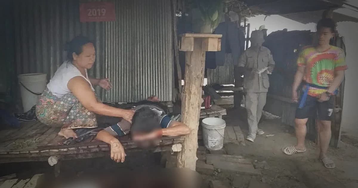 หนุ่มเมียนมาเมาคลั่ง ใช้กรรไกรแทงคอตัวเองหวิดดับ