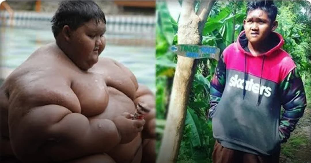 เด็กชายชาวอินโดนีเซียที่อ้วนที่สุดในโลก สามารถลดน้ำหนักออกจนผอมได้สำเร็จ