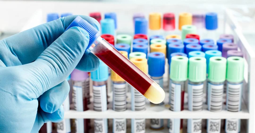 สบส. เห็นชอบให้พยาบาลเจาะเก็บตัวอย่างเลือดประเมินสุขภาพได้