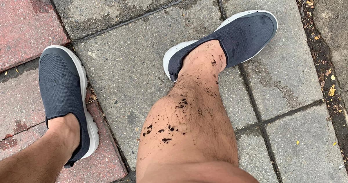 อ.ศุภเดชโพสต์ภาพถูกน้ำเน่าทางเท้ากระเด็นใส่เต็มแข้ง