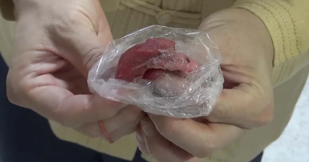 สธ.เตือน! “กินหมูดิบ” เสี่ยงโรคไข้หูดับ แนะควรปรุงสุก