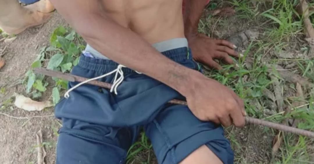 พลาดตกต้นไม้เหล็กเสียบทะลุอัณฑะ