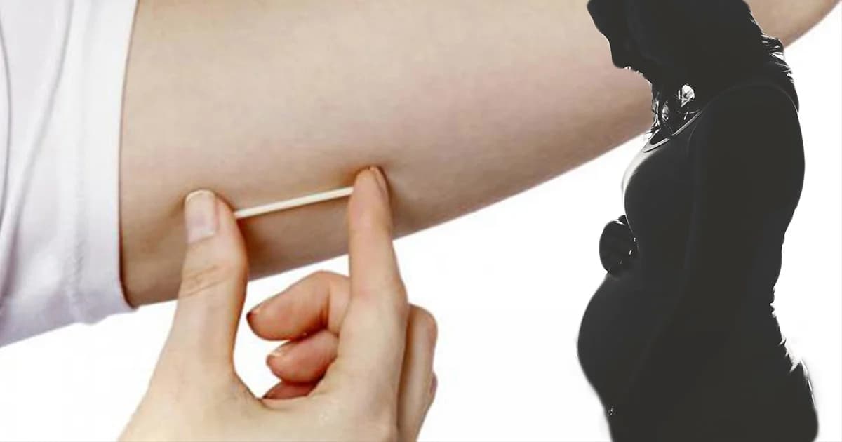 กรมอนามัยย้ำ คุมกำเนิดสำคัญลดแม่วัยใสท้องไม่พร้อม