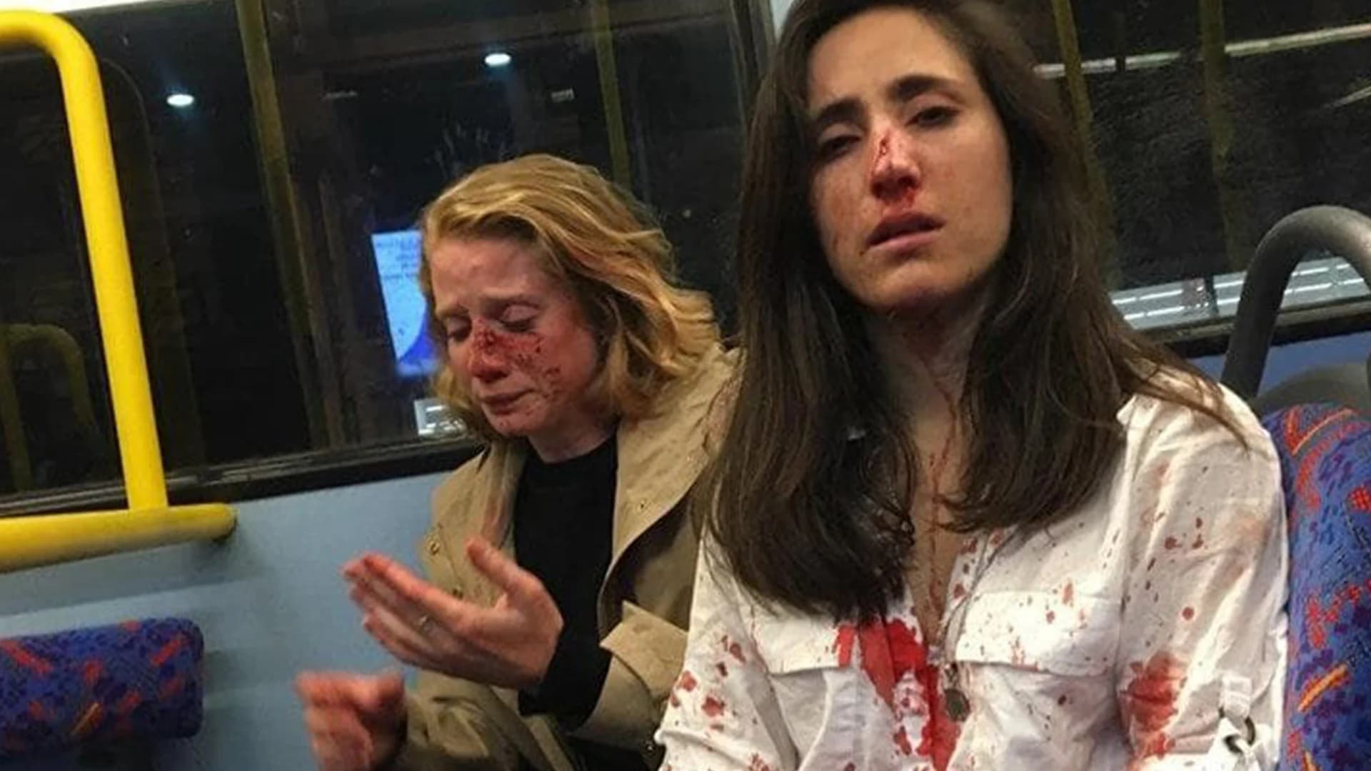 สองสาวอังกฤษถูกรุมทำร้ายบนรถบัสในลอนดอน หลังกลุ่มวัยรุ่นรู้ว่าพวกเธอเป็นเลสเบี้ยน