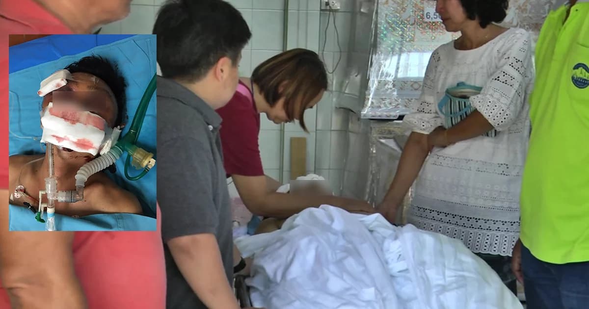 รองประธานสภาอโยธยาที่ถูกซ้อมเสียชีวิตแล้ว เลือดออกในสมองไม่หยุด