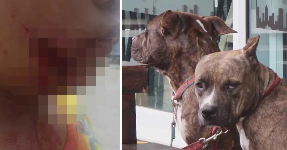 เด็กชายวัย 11 ปีผวา! ถูกพิตบูลรุมขย้ำ แม่เตรียมแจ้งความ หากเจ้าของไม่ย้ายสุนัขออกจากพื้นที่