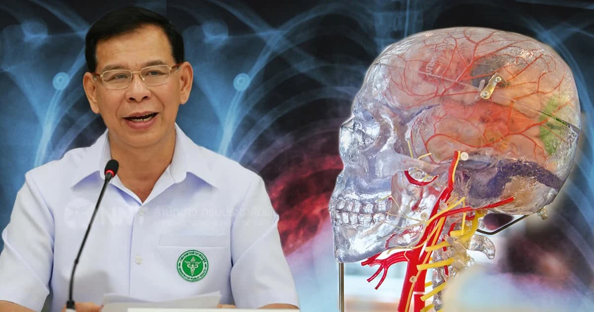 สธ.ย้ำวัณโรครักษาหายขาดได้ด้วยยา ได้ผลดีหากรักษาตั้งแต่ระยะแรก