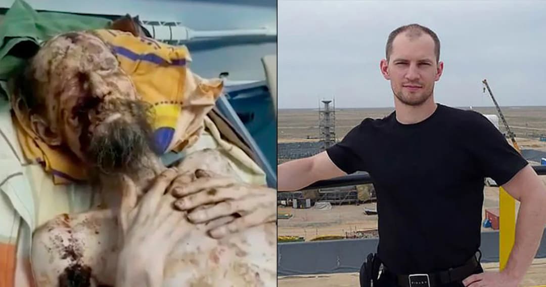 ชายอ้างถูกหมีเก็บไว้เป็นเสบียง ที่แท้ป่วยโรคสะเก็ดเงิน