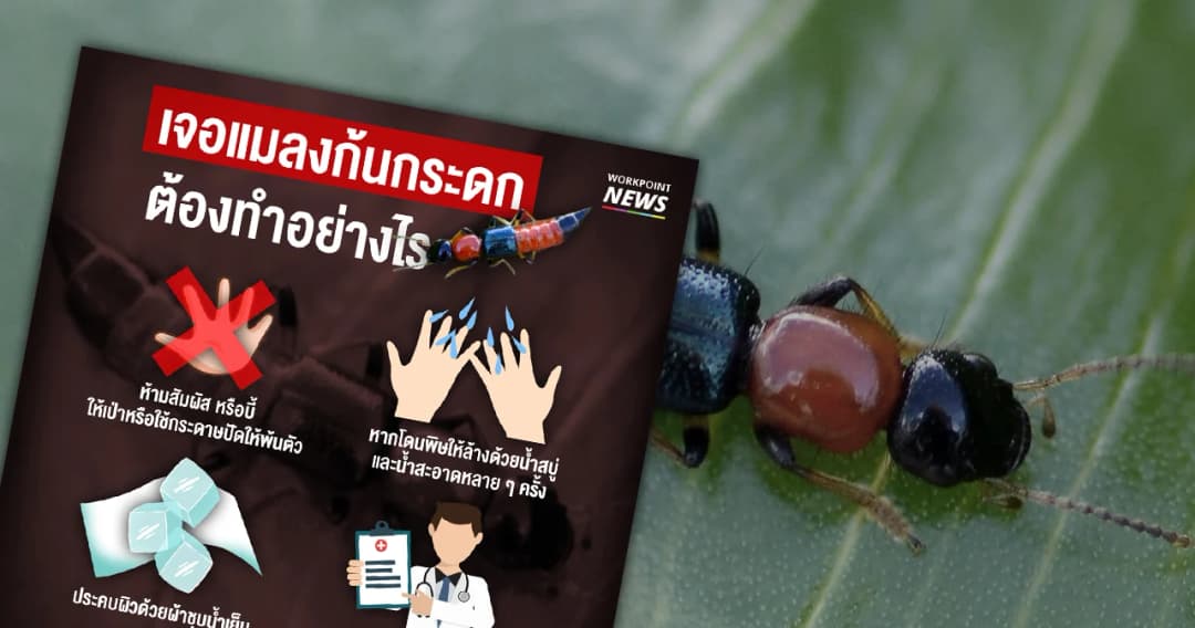 แนะ 4 วิธีปฏิบัติ หากโดนพิษแมลงก้นกระดก