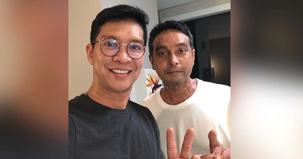 “หนุ่ม คงกะพัน” เผย “วินัย ไกรบุตร” แผลหาย 80% ตุ่มไม่ขึ้นเพิ่มแล้ว