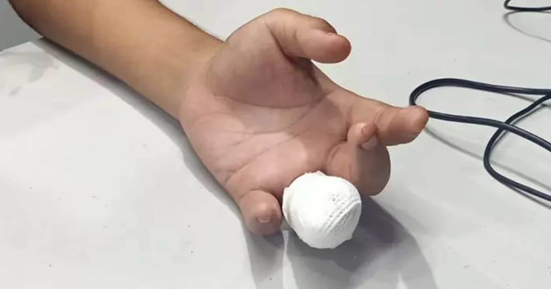 ผู้โดยสารถูกประตูรถเมล์สาย 82 หนีบนิ้วขาด ขณะลงจากรถ