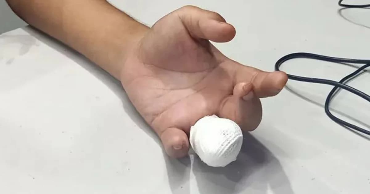 ผู้โดยสารถูกประตูรถเมล์สาย 82 หนีบนิ้วขาด ขณะลงจากรถ