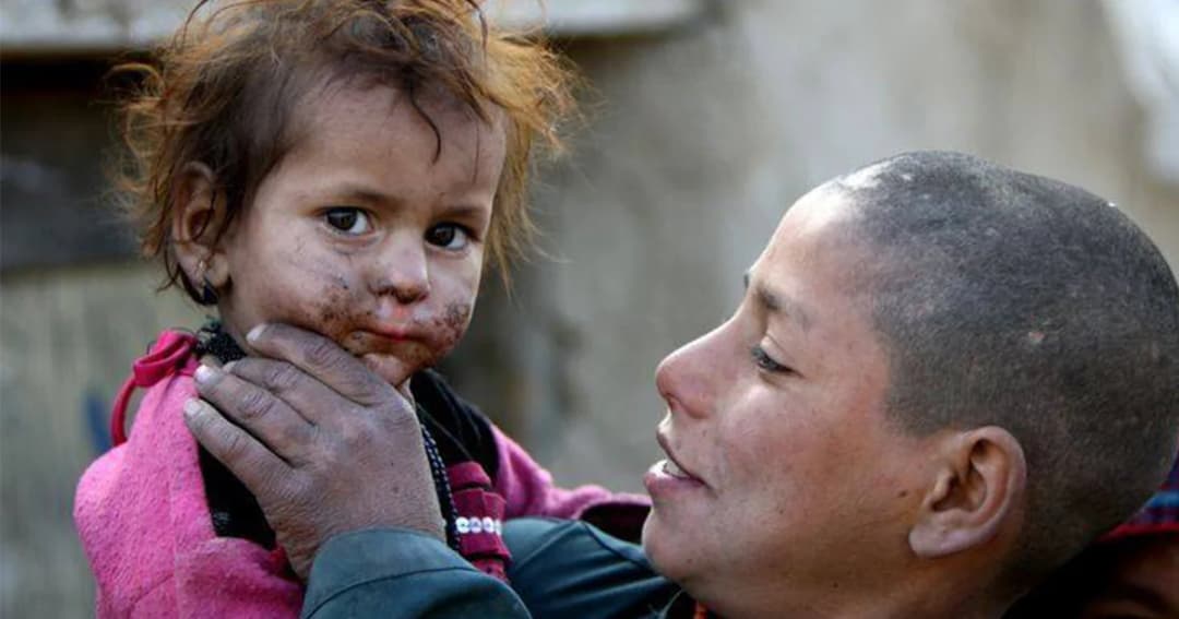 ยูเอ็นชี้ประชาชน 1.3 ล้านคนทั่วโลก “ยากจนหลายมิติ”