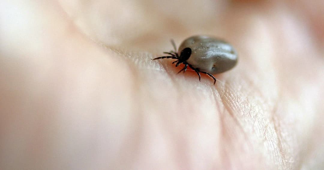 พบผู้ป่วย “โรคลายม์” รายแรกของไทย หลังกลับจากตุรกี รักษาหายแต่เสียความทรงจำ