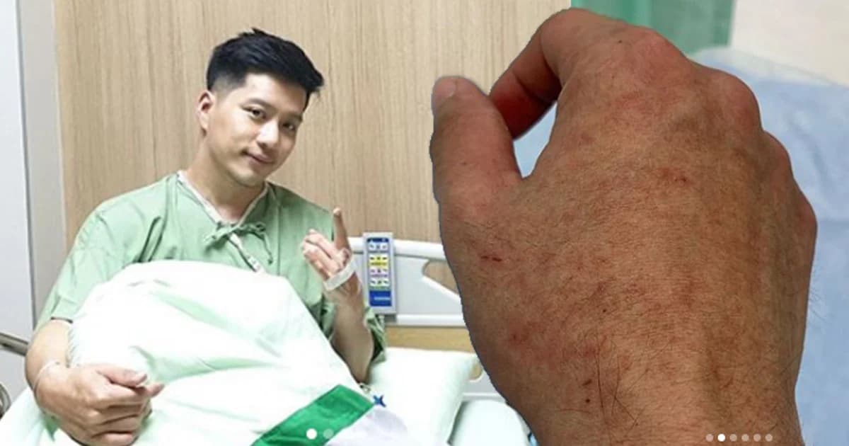 “ตี๋ เอเอฟ” นอน รพ. ป่วย “ไข้เลือดออก” กรมควบคุมโรค เผยปี’62 ป่วยแล้ว 4.5 หมื่นคน