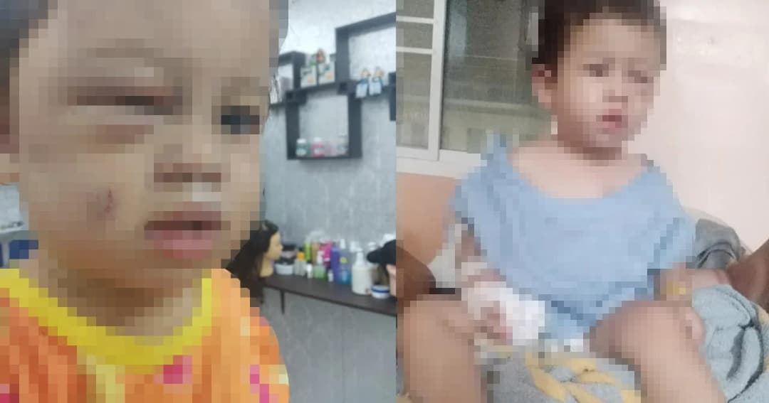 พี่เลี้ยงโหด! แม่ร่ำไห้จ้างเลี้ยงลูกสาววัย 1 ขวบ พบถูกทำร้ายบาดแผลเต็มตัว