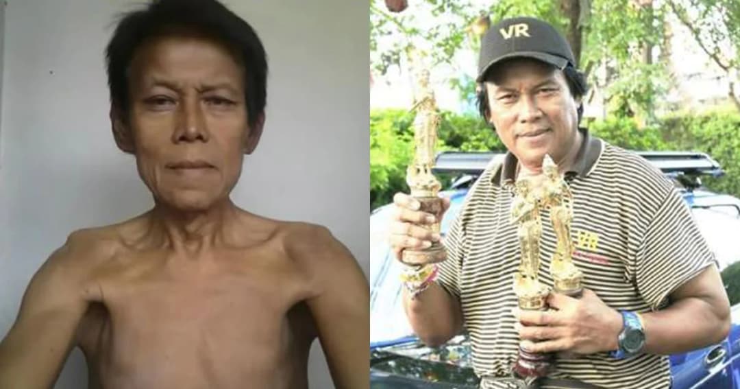 เปิดใจ “เป้า ปรปักษ์” ผกก.สายบู๊ ป่วยหนักจนซูบผอม